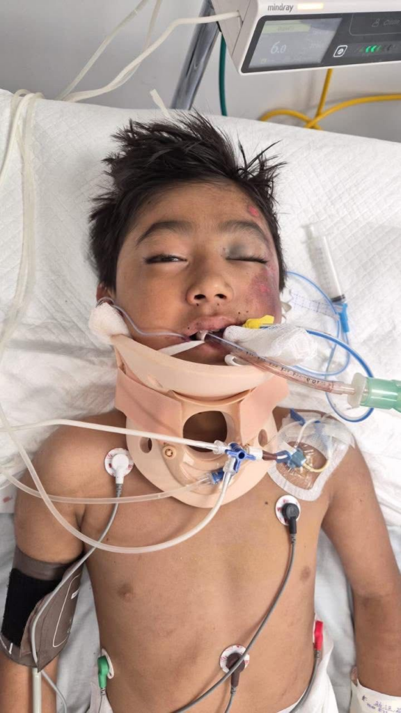 carretera Tlapa–Puebla